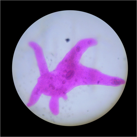 Amoeba