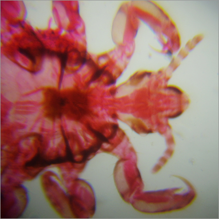 Mouth Part of Head Louse