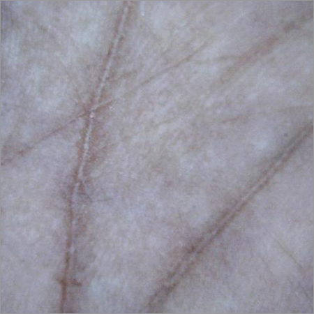 Opeque Surface of Palm