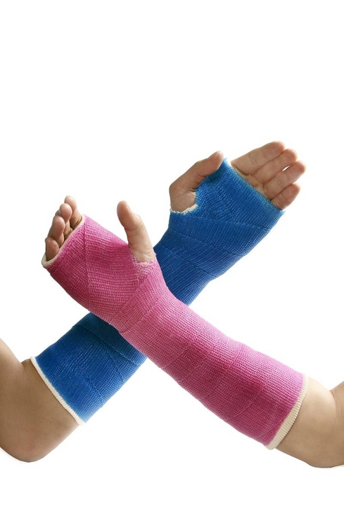 Orthopedic Cast (Fiberglass)