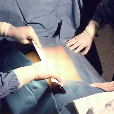 Disposable Incise Drape