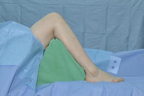 Orthopedic Products