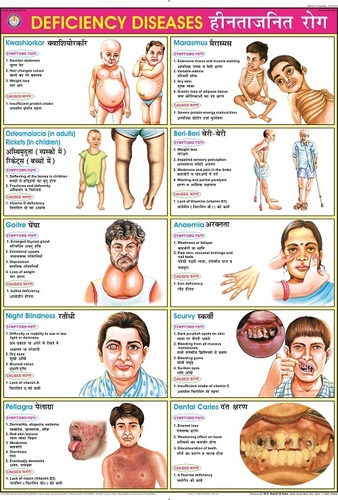 Deficiency Diseases Chart