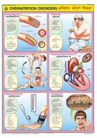 Overnutrition Disorders Chart
