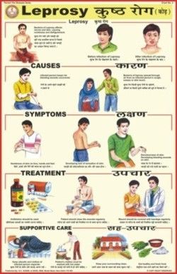 Leprosy Chart