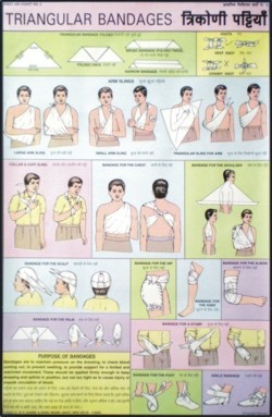 Triangular bandages Chart