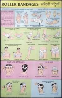 Roller Bandages Chart Dimensions: 50 A  75  Centimeter (cm)