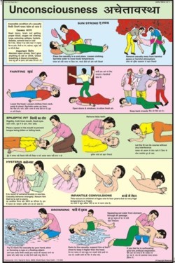 Unconsciousness Chart