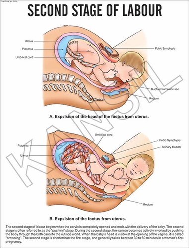 Second Stage of labour