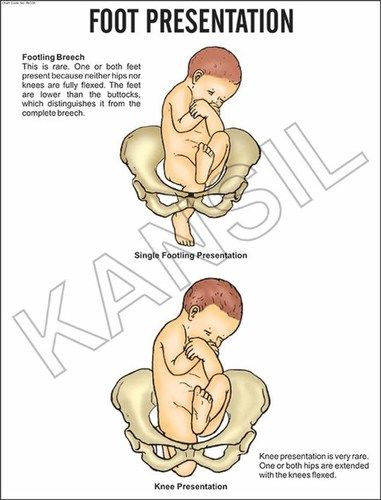 Foot Presentation Chart