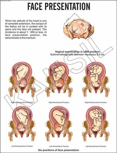 Full Colour Face Presentation Chart