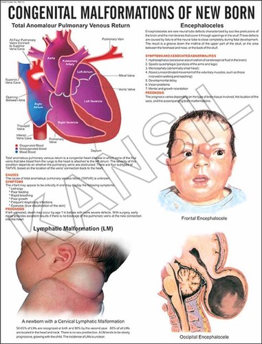 Congenital Malformation Of New Born Chart