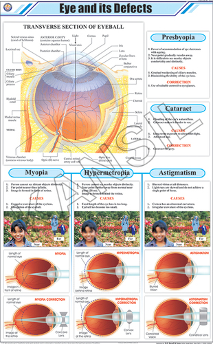 Eye and its Defects Chart
