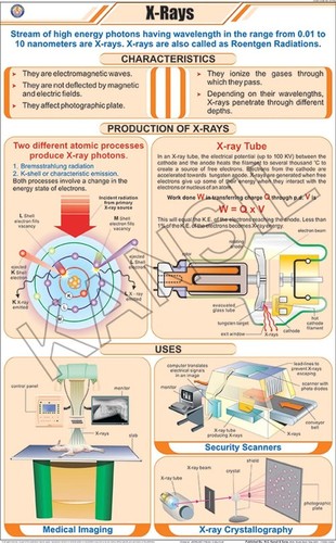 X-Ray Chart