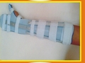 Full Hand Splint