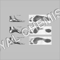 Pc 959 FootDoc Bio-Mechanical Analysis - Paper