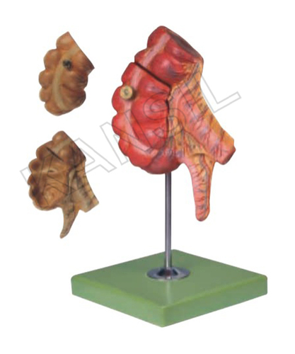 Appendix And Caecum Model