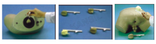 Prostate Inspection Model