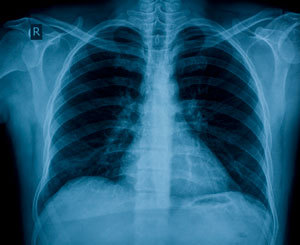 Scrap X-Ray Film - Silver Halide Sheets, Variable Size | Silver Recovery, Recycling, Local Compliance, Environmentally Friendly