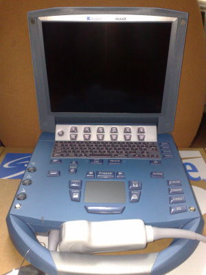 Color Doppler Ultrasound Scanner