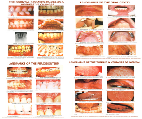 Dentistry Charts