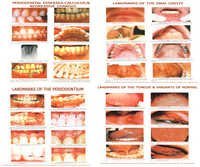 Zahnheilkunde-Diagramme