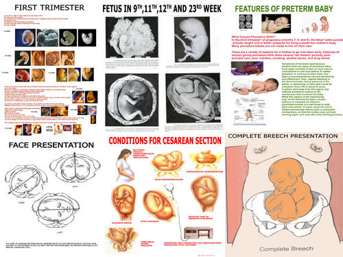 Charts on Obstetric & Gynaecology