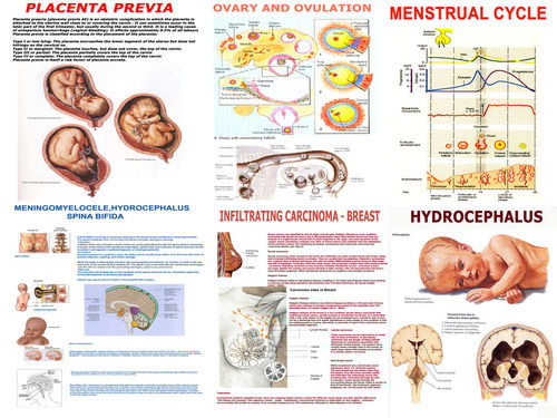 Charts on Obstetric & Gynaecology