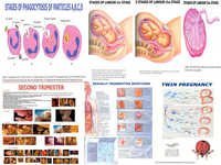 Charts on Obstetric & Gynaecology