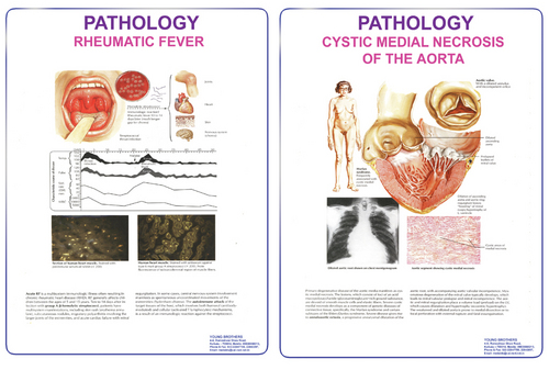 Charts on Pathology