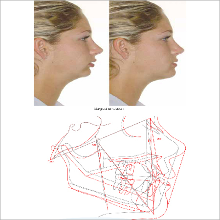 Treatment Simulation