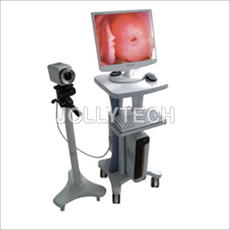Digital Colposcope