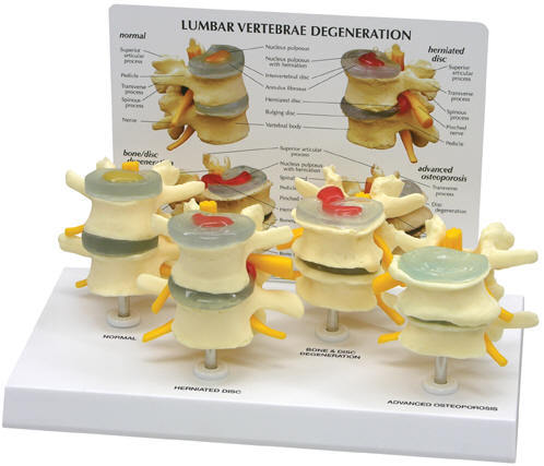 Vertebrae  Model