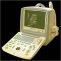 Digital Ultrasound Diagnostic Device