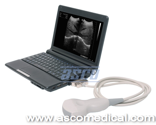 Laptop Ultrasound Scanner US1122