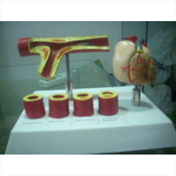 Arteries With Heart Models