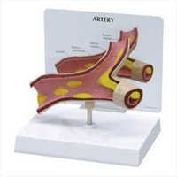 Heart Artery Models - Color: White And Red