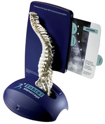 Ankylosing Spondylitis Spine Model