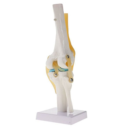 Knee Arthritis Model