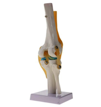 Modelo do Arthritis do joelho
