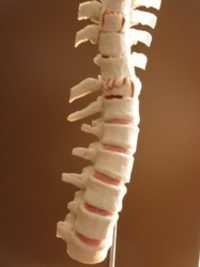 Modelo fraturado do Spine
