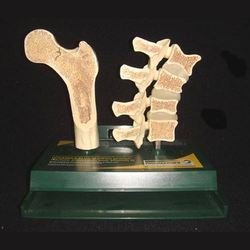 femur & vertebrae osteoporosis model