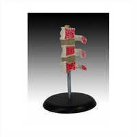 osteoporosis of vertebrae Model