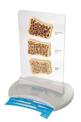 Roche - Boniva Bone Model