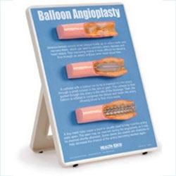 Plastic Balloon Angioplasty Models