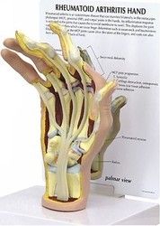 Safe To Use Hand Arthritis Model