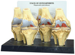 Knee Arthritis Model