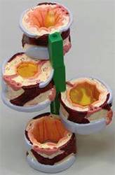 Bronchus Model