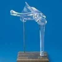 Transparent Shoulder Joint Model