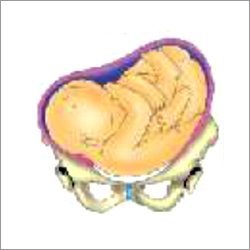 effect of shoulder presentation